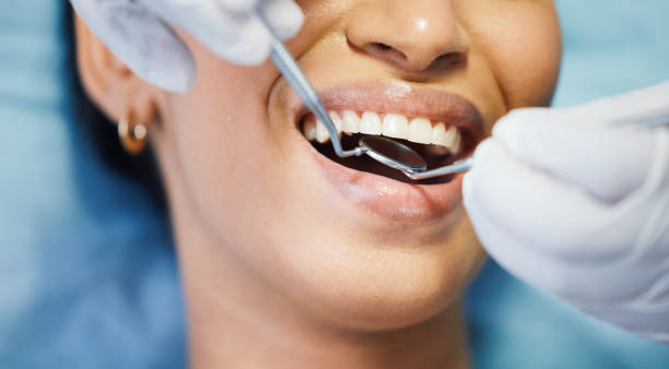 Best Lost Filling or Crown Replacement in Yardville, NJ